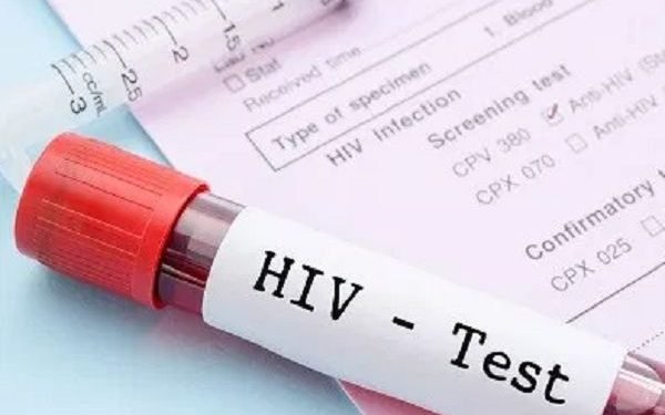 Western Region: Over 23,000 living with HIV, 3 infections recorded daily